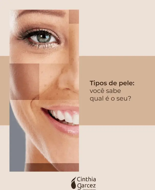 Desvendando os 5 tipos de peles