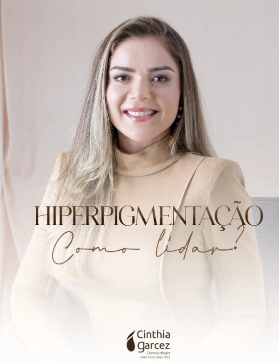 Hiperpigmentação na Pele: Causas, Sintomas, Diagnóstico, Tratamento e PrevençãoI Dermatologista Cinthia Garcês